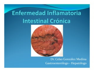 Dr. Celso González Medina
Gastroenterólogo - Hepatólogo
 