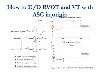 How to D/D RVOT and VT with
        ASC in origin
 