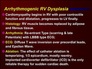 Arrhythmogenic RV Dysplasia
Cardiomyopathy begins in RV with poor contractile
function and dilatation, progresses to LV finally.
Histology: RV muscle becomes replaced by adipose
and fibrous tissue.
Arrhythmia: Re-entrant Type (scarring & late
Potentials) with LBBB type ECG;
ECG: Diffuse T wave inversion over precordial leads,
and Epsilon Wave.
Ablation: The effect of catheter ablation is
temporizing, 1/3 epicardium, mostly reentry.
Implanted cardioverter defibrillator (ICD) is the only
reliable therapy for sudden cardiac death.
 