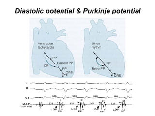 Diastolic potential & Purkinje potential
 
