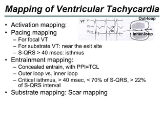 Mapping of Ventricular Tachycardia
                                                   Out-loop
• Activation mapping:
• Pacing mapping                                Inner-loop
  – For focal VT
  – For substrate VT: near the exit site
  – S-QRS > 40 msec: isthmus
• Entrainment mapping:
  – Concealed entrain, with PPI=TCL
  – Outer loop vs. inner loop
  – Critical isthmus, > 40 msec, < 70% of S-QRS, > 22%
    of S-QRS interval
• Substrate mapping: Scar mapping
 