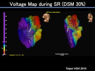 Voltage Map during SR (DSM 30%)




                      Taipei VGH 2010
 