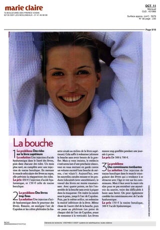 10 BOULEVARD DES FRERES VOISIN
92130 ISSY LES MOULINEAUX - 01 41 46 88 88
OCT 11
Mensuel
OJD : 431966
Surface approx. (cm²) : 5079
N° de page : 230
Page 5/10
IMCAS
2850639200504/GTH/OTO/2
Eléments de recherche : ENDYMED 3 DEEP: système de radiofréquence, toutes citations
4
La bouche
ILe problème Des rides
sur la lèvre supérieure
La solution Une injection d'acide
hyaluromque dans le liseré des lèvres,
puis dans chacune des rides Un mois
plus tard, on complète avec une injec-
tion de toxine botulique En mettant
le muscle orbiculaire des lèvres au repos,
elle prévient la réapparition des rides
Le prix 450 f l'injection d acide hya-
luromque, et 150 € celle de toxine
botulique
Le problème Des lèvres
y trop fines
r La solution Une injection d'aci-
de hyaluromque dans le pourtour des
lèvres. Ensuite, on souligne l'arc de
Cupidon et les crêtes philtrales (la fos-
sette située au milieu de la lèvre supé-
rieure) Cela suffit à redessiner joliment
la bouche sans avoir besoin de la gon-
tier. Maîs si vous insistez, le médecin
s exécutera lors d'une prochaine séance,
tout en vous mettant en garde contre
un volume excessif(une bouche de mé-
rou, cest vilain!) Aujourd'hui, avec
les nouvelles canules mousse et les pro-
duits lidocai'nés (avec anesthésiant), le
travail des lèvres est moins traumati-
sant Avec quatre points, on fait I en-
semble de la bouche sans avoir à piquer
dans la muqueuse On insère la canule
sous la peau, jusqu'à l'arc de Cupidon
Puis, par le même orifice, on redessine
la moitié inférieure de la lèvre Même
chose de l'autre côté de la bouche, puis
on passe au philtrum (un point de
chaque côté de l'arc de Cupidon, avant
de remonter à la verticale) Les lèvres
restent trop gonflées pendant une jour-
née à peine
Le prix De 500 à 700 €
3
Leproblème
Des commissures tombantes
La solution Une injection de
toxine botulique dans le muscle trian-
gulaire des lèvres qui a tendance à se
rétracter avec I âge er tire sur les com-
missures Maîs il faut avoir la mam très
sûre pour ne pas entraîner une asymé-
trie du sourire, voire des difficultés à
boire sans baver On peut également
combler les commissures avec de l'acide
hyaluromque
Le prix 150 € la toxine botulique,
300 € l'acide hyaluromque
 