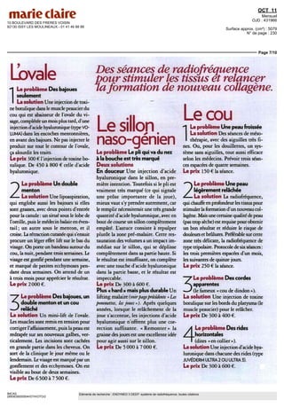 10 BOULEVARD DES FRERES VOISIN
92130 ISSY LES MOULINEAUX - 01 41 46 88 88
OCT 11
Mensuel
OJD : 431966
Surface approx. (cm²) : 5079
N° de page : 230
Page 7/10
IMCAS
2850639200504/GTH/OTO/2
Eléments de recherche : ENDYMED 3 DEEP: système de radiofréquence, toutes citations
Lbval
I
le problème Des bajoues
seulement
La solution Une injection de toxi-
ne botulique dans le musclepeaucierdu
cou qui est abaisseur de l'ovale du vi-
sage, complétée un mois plus tard, d'une
injectiond'acidehyaluronique(typeVO-
LUMA) dans les encoches mentonnières,
en avant des bajoues. Ne pas injecter le
produit sur tout le contour cle l'ovale,
ça alourdit les traits.
Le prix 300 € l'injection de toxine bo-
tulique. De 450 à 800 € celle dacide
hyaluronique.
*~ Le problème Un double
J menton
Z— La solution Une lipoaspiration,
qui englobe aussi les bajoues si elles
sont grasses, avec deux points d'entrée
pour la canule : un situé sous le lobe de
l'oreille,puis lemédecin balaieenéven-
tail ; un autre sous le menton, et il
croise.Larétractioncutanéequis'ensuit
procure un léger effet lift sur le bas du
visage. On porte un bandeau autour du
cou, lanuit,pendanttroissemaines. Le
visage est gonflé pendant une semaine,
et marqué de petites ecchymoses pen-
dant deux semaines. On attend de un
à trois mois pour apprécier le résultat.
Le prix 2 000 €.
~~7 Le problème Des bajoues, un
^ double menton et un cou
~J relâché
La solution Un mini-lift de l'ovale.
Les muscles sont remis en tension pour
corriger l'affaissement, puis lapeau est
redrapée sur ses nouveaux galbes, ver-
ticalement. Les incisions sont cachées
en grande partie dans les cheveux. On
sort de la clinique le jour même ou le
lendemain. Levisage est marqué par un
gonflement et des ecchymoses. On est
visible au bout de deux semaines.
Le prix De 6 500 à 7 500 €.
Des séances de radiofréquence
pour stimuler les tissus et relancer
laformation de nouveau collagène.
Le sillon
naso-génien
Leproblème Le pli quivadu nez
à la bouche est très marque
Deux solutions
En douceur Une injection d'acide
hyaluronique dans le sillon, en pre-
mière intention. Toutefois si le pli est
vraiment très marqué (ce qui signale
une ptôse importante de la joue),
mieux vaut s'y prendre autrement, car
le remplir nécessiterait une trèsgrande
quantitéd'acidehyaluronique,avecen
bout de course un sillon complètement
empâté. L'astuce consiste à repulper
plutôt la zone pré-malaire. Cette res-
tauration des volumes a un impact im-
médiat sur le sillon, qui se déplisse
complètement dans sa partie haute. Si
le résultat est insuffisant, on complète
avec une touche d'acide hyaluronique
dans la partie basse, et le résultat est
impeccable.
Le prix De 300 à 600 €.
Plus « hard » mais plus durable Un
lifting malaire (voirpageprécédente « Les
pommettes, lesjoues»). Aprèsquèlques
années, lorsque le relâchement de la
joue s'accentue, les injections d'acide
hyaluronique n'offrent plus une cor-
rection suffisante. « Remonter » la
graissedes jouesest uneexcellenteidée
pour agir aussi sur le sillon.
Le prix De 5 000 à 7 000 €.
Le cou
I
Le problème Une peau froissée
La solution Des séances de méso-
thérapie, avec des aiguilles très fi-
nes. Ou, pour les douillettes, un sys-
tème sans aiguilles, tout aussi efficace
selon les médecins. Prévoir trois séan-
ces espacées de quatre semaines.
Le prix 150 € la séance.
*"* Le problème Une peau
J légèrement relâchée
f La solution La radiofréquence,
quichauffeenprofondeurlestissuspour
stimulerlaformationd'unnouveaucol-
lagène.Maisunecertainequalitédepeau
(pas trop sèche) est requise pour obtenir
un bon résultat et réduire le risque de
douleurset brûlures. Préférablesurcette
zone très délicate, la radiofréquence de
type tripolaire. Protocole de sixséances :
les trois premières espacées d'un mois,
lessuivantesdequinzejours.
Le prix 250 € la séance.
Le problème Des cordes
apparentes
•— J (le fameux « cou de dindon »).
La solution Une injection de toxine
botulique sur les bords du platysma (le
muscle peaucier) pour le relâcher.
Le prix De 300 à 400 €.
A Le problème Des rides
sl horizontales
I (dites «en collier»).
La solution Une injection d'acide hya-
luronique dans chacune des rides (type
JUVÉDERM ULTRA 2 OU ULTRA 3).
Le prix De 300 à 600 €.
 