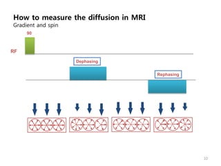 Diffusion Weighted MRI (2011-09-29 이정원) | PPTX