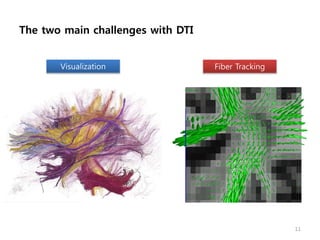 The two main challenges with DTI
11
Visualization Fiber Tracking
 
