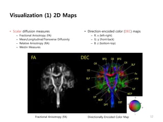 Visualization (1) 2D Maps
• Scalar diffusion measures
– Fractional Anisotropy (FA)
– Mean/Longitudinal/Transverse Diffusivity
– Relative Anisotropy (RA)
– Westin Measures
• Direction-encoded color (DEC) maps
– R: x (left-right)
– G: y (front-back)
– B: z (bottom-top)
12Fractional Anisotropy (FA) Directionally-Encoded Color Map
FA DEC
 