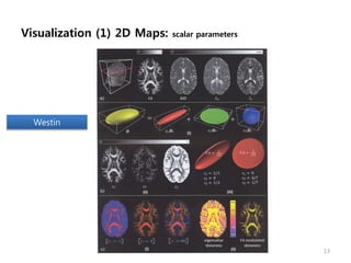 Visualization (1) 2D Maps: scalar parameters
13
Westin
 