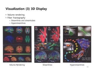 Visualization (3) 3D Display
• Volume rendering
• Fiber Tractography
– Streamlines and streamtubes
– Hyperstreamlines
16
HyperstreamlinesVolume Rendering Streamlines
 