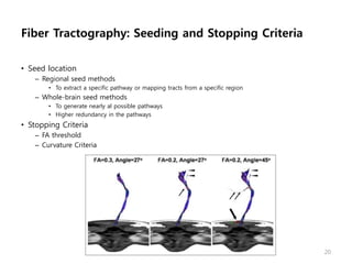 Fiber Tractography: Seeding and Stopping Criteria
• Seed location
– Regional seed methods
• To extract a specific pathway or mapping tracts from a specific region
– Whole-brain seed methods
• To generate nearly al possible pathways
• Higher redundancy in the pathways
• Stopping Criteria
– FA threshold
– Curvature Criteria
20
 