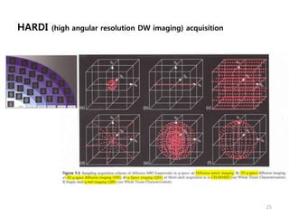 HARDI (high angular resolution DW imaging) acquisition
25
 