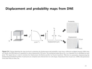 Displacement and probability maps from DWI
28
 