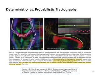 Deterministic- vs. Probabilistic Tractography
33
Tournier, J.-D., Mori, S., and Leemans, A. (2011). “Diffusion tensor imaging and beyond.”
Magnetic resonance in medicine : official journal of the Society of Magnetic Resonance
in Medicine / Society of Magnetic Resonance in Medicine, 65(6), pp. 1532-56.
 