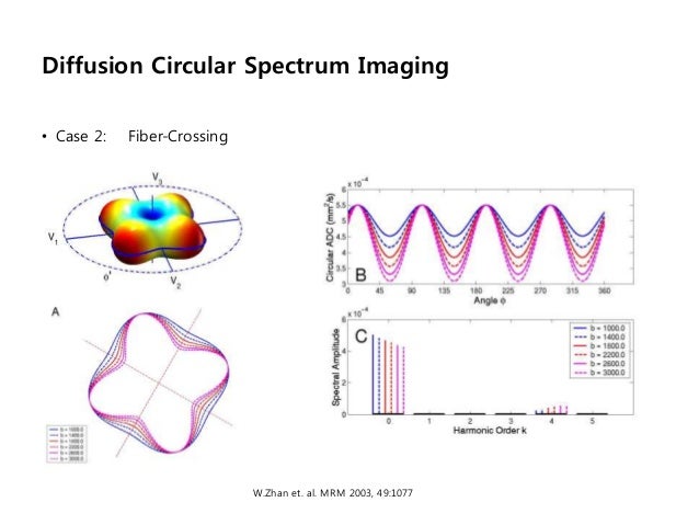 Diffusion Tensor Imaging (2011-10-04 이정원)