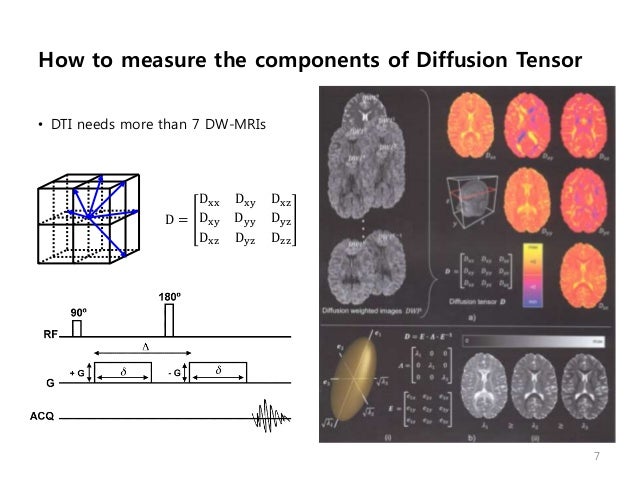 Diffusion Tensor Imaging (2011-10-04 이정원)