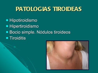 PATOLOGIAS TIROIDEAS Hipotiroidismo Hipertiroidismo Bocio simple. Nódulos tiroideos Tiroiditis 