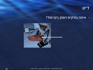 ‫דיון:‬
                                 ‫• איפה בודקים דופק בקרסול?‬




‫28‬   ‫(‪ )C‬כל הזכויות שמורות - אלעד גתי וצחי הולצברג, מד"א ירושלים‬
 