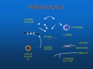 粘液分泌过多 嗜酸性细胞 肥大细胞 抗原 Th2  细胞 血管扩张 新血管形成 血浆渗出 水肿形成 中性粒细胞 粘 液 栓 巨噬细胞 / 树突状细胞 平滑肌收缩 肥大  /  增生 胆碱能反射 上皮脱落 上皮纤维化 感觉神经激活 神经激活 哮喘的现代观点 