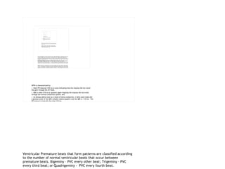 Ventricular Premature beats that form patterns are classified according to the number of normal ventricular beats that occur between premature beats. Bigeminy – PVC every other beat; Trigeminy – PVC every third beat; or Quadrigeminy -  PVC every fourth beat.  