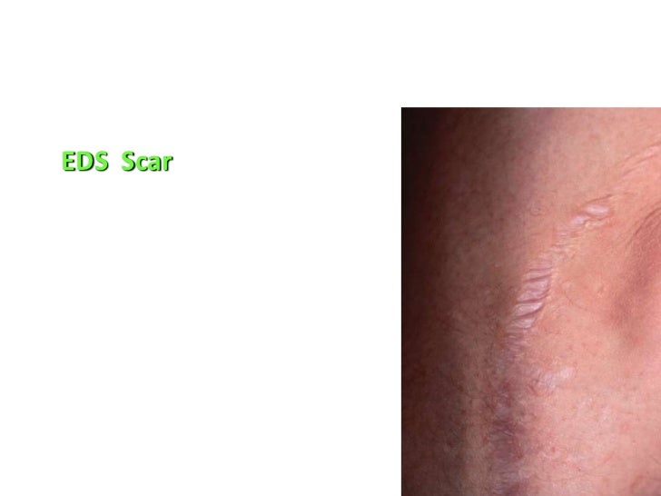 Medicine 6th year, Dermatology Tutorial (1st session)