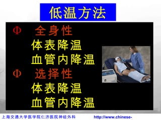 全身性 体表降温 血管内降温 选择性 体表降温 血管内降温   低温方法 