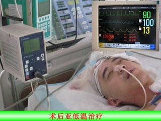 术后亚低温治疗  