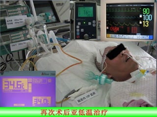 再次术后亚低温治疗  