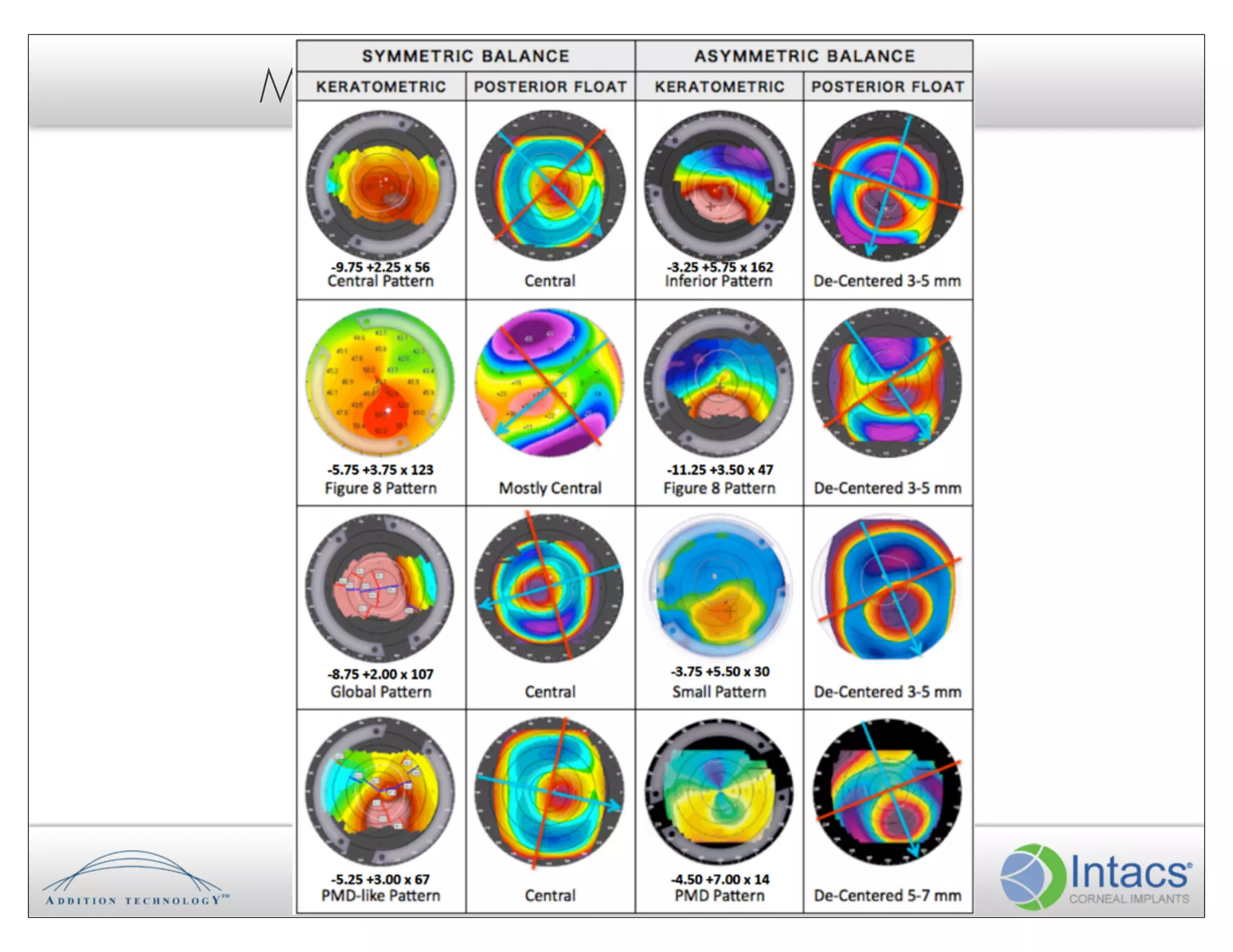 More Pre-Surgical Case Examples?
 
