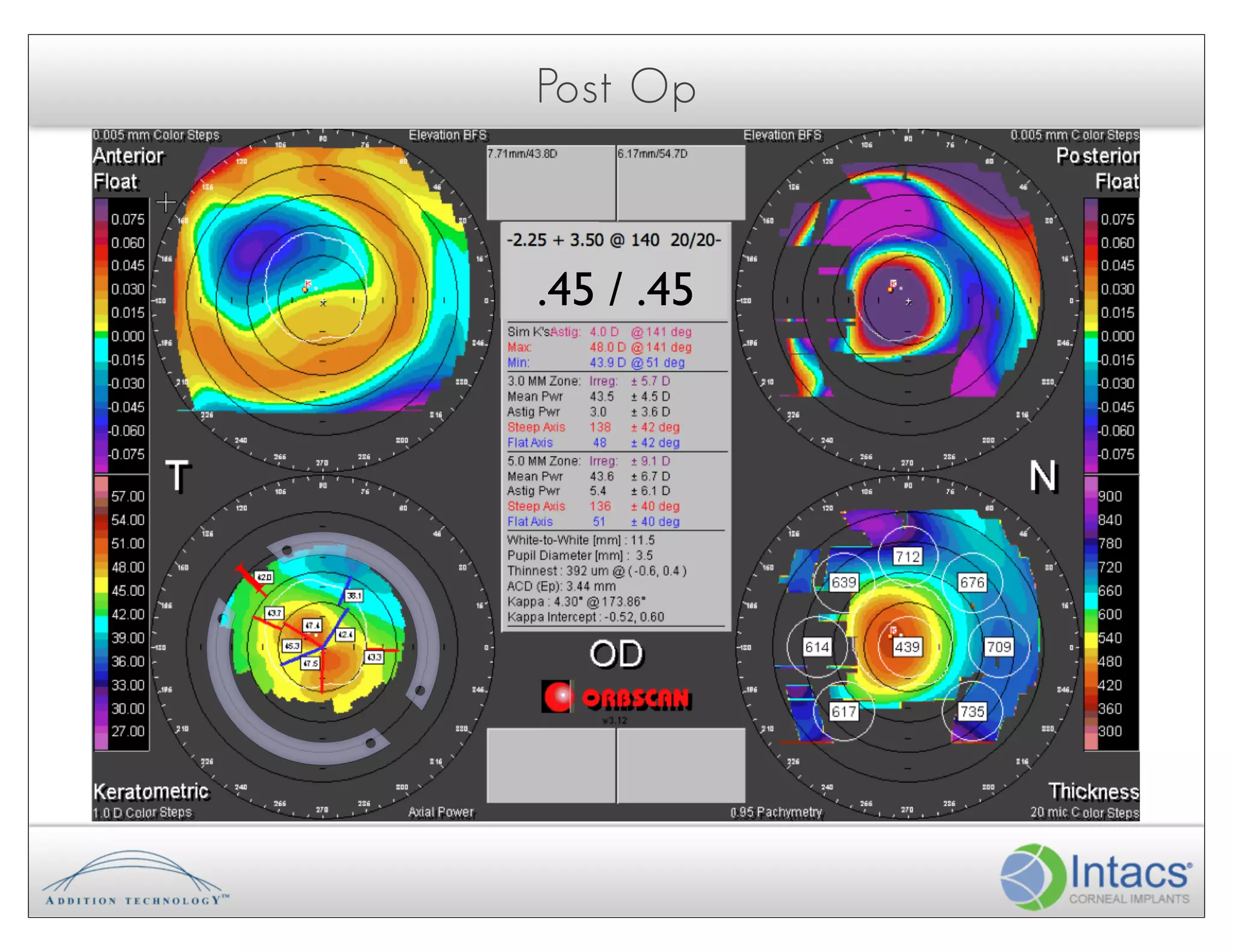 Post Op



     .45 / .45
I!
 