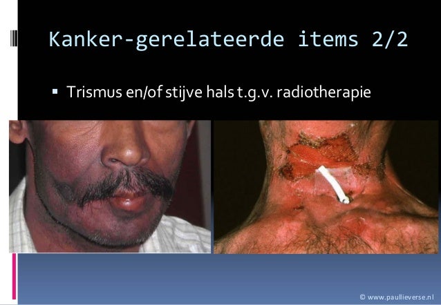 stijve lies