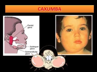 CAXUMBA
 