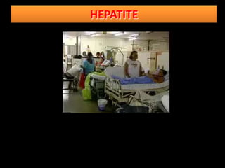 HEPATITE
 