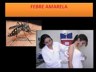 FEBRE AMARELA
 