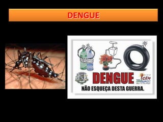 DENGUE
 