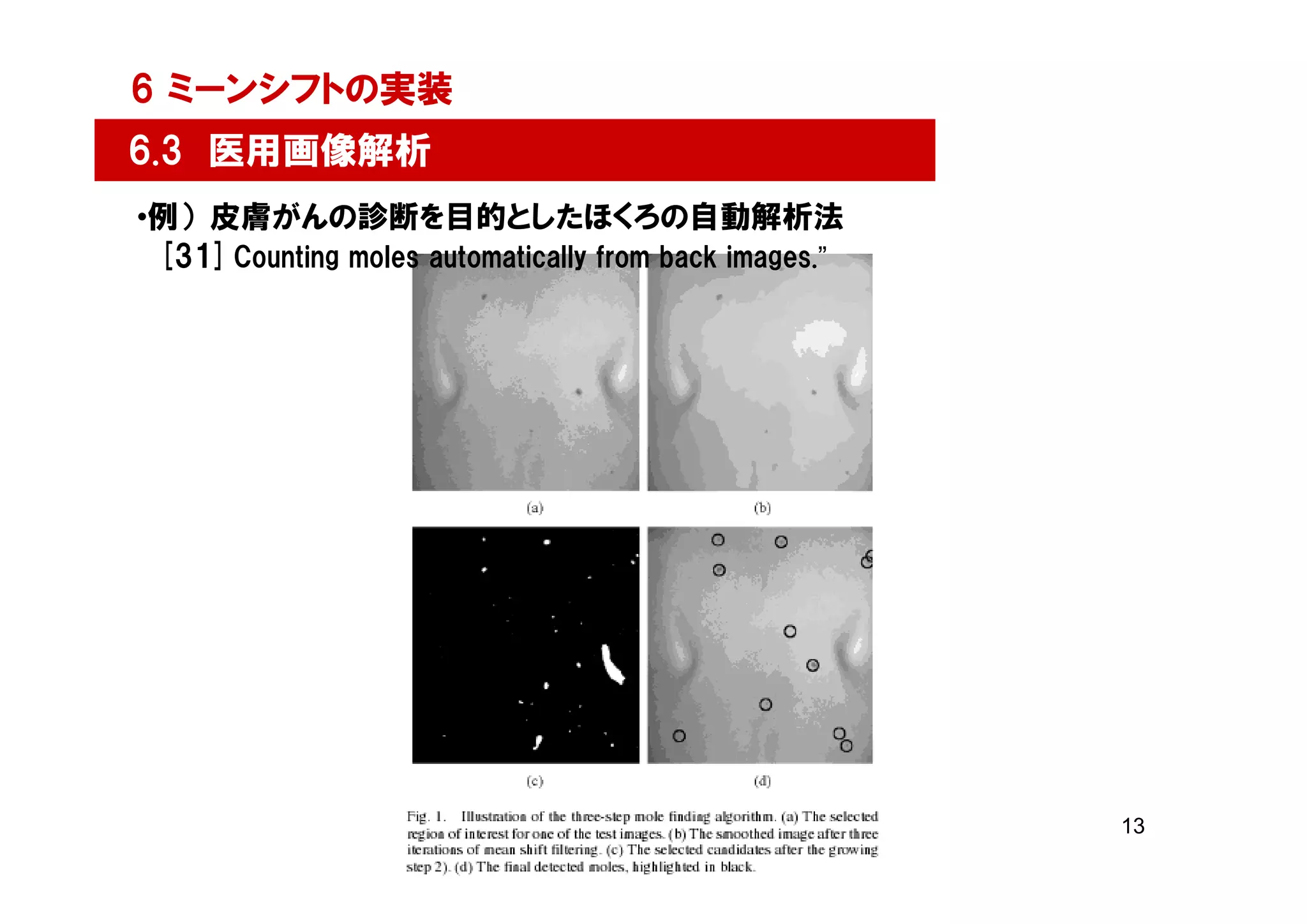 6 ミーンシフトの実装
6.3 医用画像解析
•例）皮膚がんの診断を目的としたほくろの自動解析法
 [31] Counting moles automatically from back images.”




                                                        13
 
