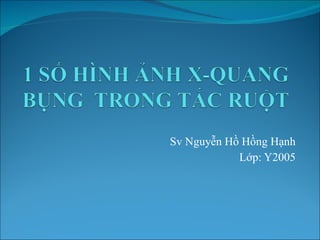 Sv Nguyễn Hồ Hồng Hạnh Lớp: Y2005 