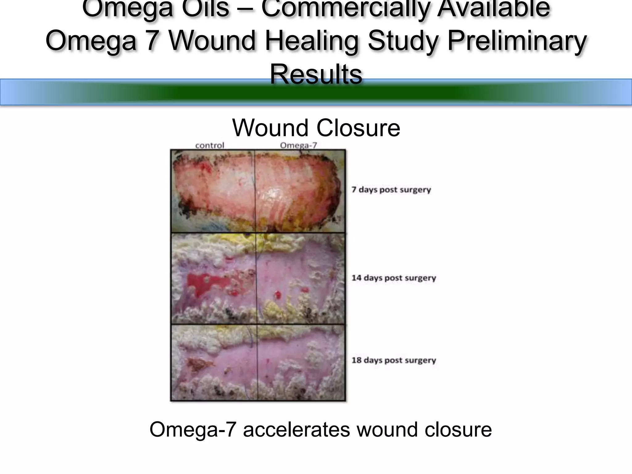  Certain kinds of algae make products that we’re interested in