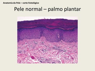 Anatomia da Pele – corte histológico Pele normal – palmo plantar
