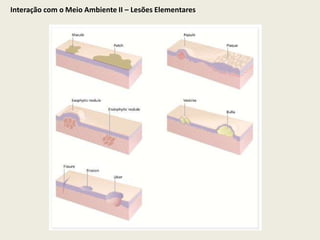 Interação com o Meio Ambiente II – Lesões Elementares 