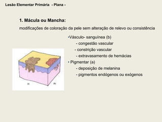 Lesão Elementar Primária  - Plana -1. Mácula ou Mancha: modificações de coloração da pele sem alteração de relevo ou consistênciaVásculo- sanguínea (b)	- congestão vascular      - constrição vascular - extravasamento de hemácias Pigmentar (a)- deposição de melanina- pigmentos endógenos ou exógenos