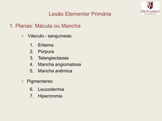 Lesão Elementar Primária 1. Planas: Mácula ou Mancha  Vásculo - sanguíneas:EritemaPúrpuraTelangiectasiasMancha angiomatosaMancha anêmica   Pigmentares:LeucodermiaHipercromia