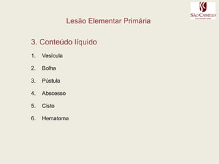  generalizada (síndrome de Cushing, Doença de Addison, porfiria, pelagra)