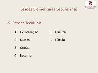 Lesão Elementar Primária – Conteúdo líquido – 3.2. BolhaElevação circunscrita da pele, maior que 1cm. Situa-se na epiderme ou entre a epiderme e a derme. Seu conteúdo é inicialmente seroso e claro - pode depois ser purulento ou hemorrágico. Dependendo do nível de formação, a bolha pode ser flácida e fugaz (como nos pênfigos) ou tensa e duradoura (como na dermatite herpetiforme de Dühring - Brocq). Quando a bolha é provocada por queimadura, denomina-se flictena .