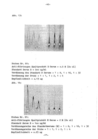 -46-



Abb. 13:




Proben Nr. 81:
Anti-Fibrinogen Spaltprodukt D Serum = 0.5 % (20 ul)
Standard Serum D = 200 ug/ml
VerdUnnung des Standard D Serums = 1   8, 1 : 16, 1 : 32
VerdUnnung der Probe = 1 : 1, 1 : 2, 1 : 4
Empfindlichkei t = 0,.13 ug
Abb. 14:




Proben Nr. 81:
Anti-Fibrinogen Spaltprodukt E Serum = 2 % (80 ul)
Standard Serum E = 100 ug/ml
VerdUnnungsreihe des Standardserums (E) ~ 1 : 8,     16, 1 : 32
VerdUnnungsreihe der Probe = 1 : 1, 1 : 2, 1 : 4
Empfindlichkeit = 0.25 ug
 