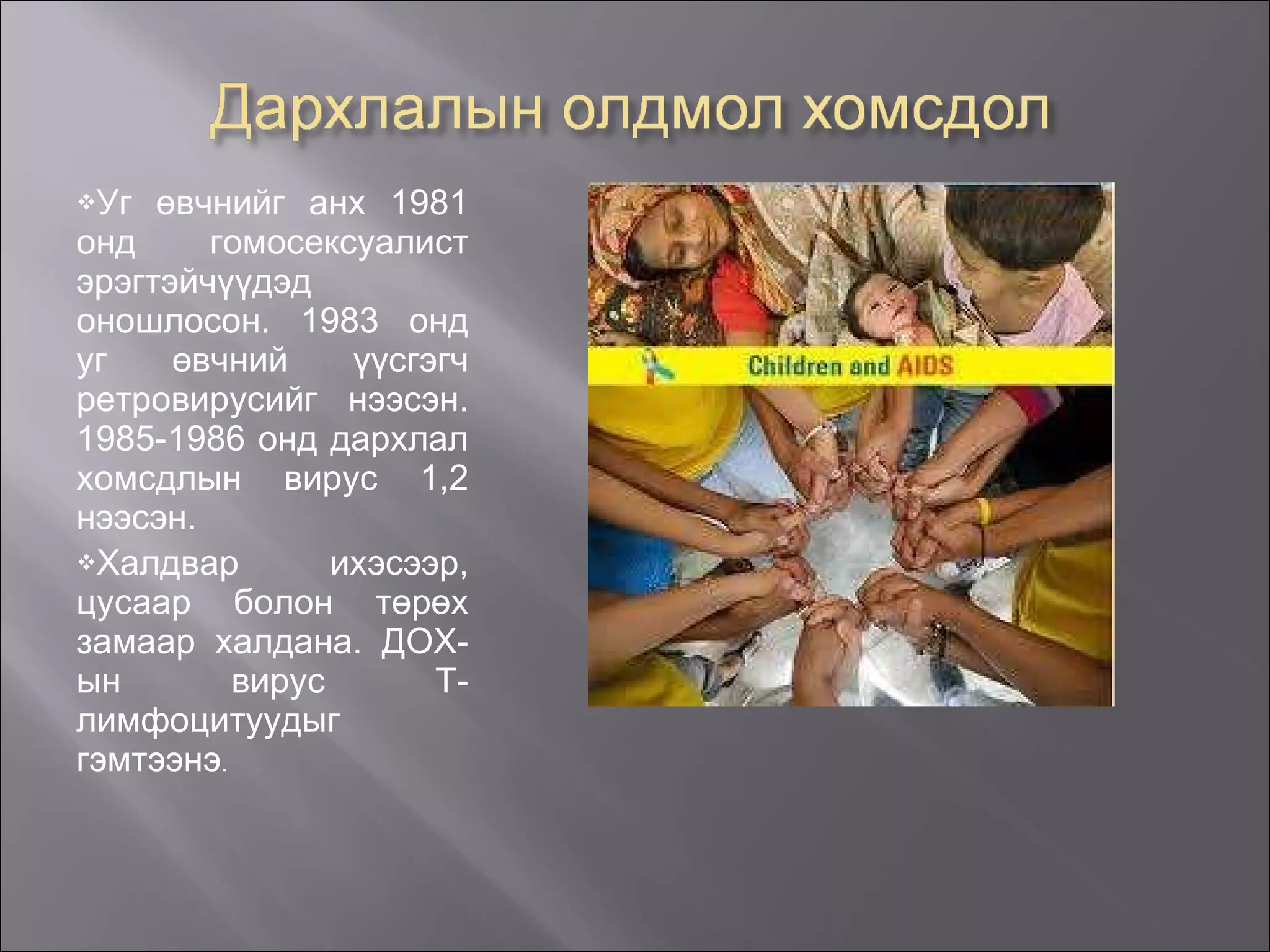 Уг өвчнийг анх 1981 онд гомосексуалист эрэгтэйчүүдэд оношлосон. 1983 онд уг өвчний үүсгэгч ретровирусийг нээсэн. 1985-1986 онд дархлал хомсдлын вирус 1,2 нээсэн. Халдвар ихэсээр, цусаар болон төрөх замаар халдана. ДОХ-ын вирус Т-лимфоцитуудыг гэмтээнэ . 