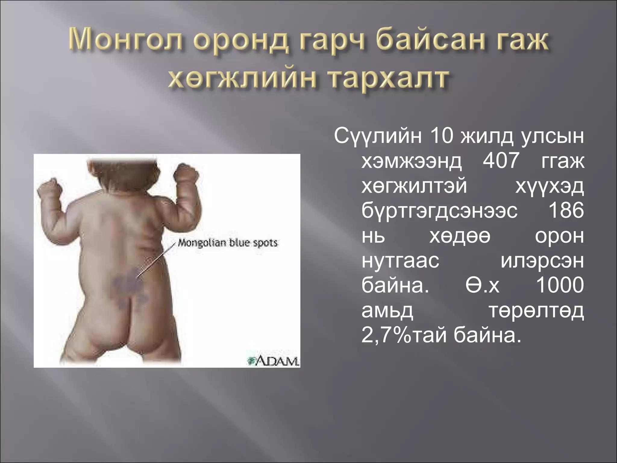 Сүүлийн 10 жилд улсын хэмжээнд 407 ггаж хөгжилтэй хүүхэд бүртгэгдсэнээс 186 нь хөдөө орон нутгаас илэрсэн байна. Ө.х 1000 амьд төрөлтөд 2,7 % тай байна. 