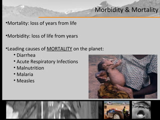 Morbidity & Mortality Mortality: loss of years from life Morbidity: loss of life from years Leading causes of  MORTALITY  on the planet: Diarrhea Acute Respiratory Infections Malnutrition Malaria Measles 