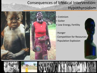 + Cretinism + Goiter + Low Energy, Fertility - Hunger - Competition for Resources - Population Explosion Consequences of Medical Intervention: Hypothyroidism 