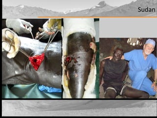 Sudan 