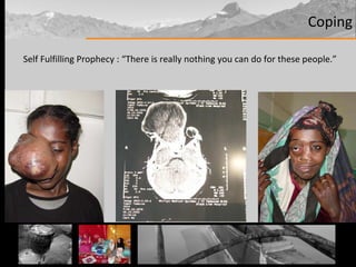 Coping Self Fulfilling Prophecy : “There is really nothing you can do for these people.” 